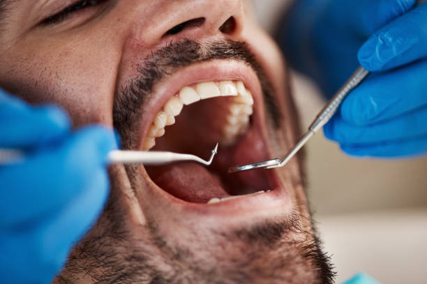 Best Weekend Emergency Dentist in Willow Park, TX